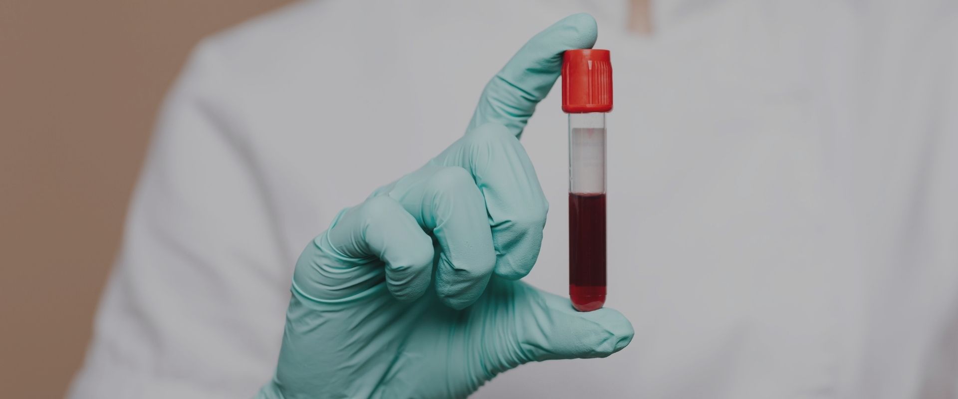 Laboratóriumi vizsgálatok